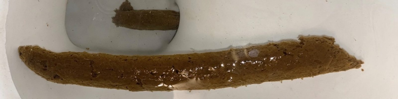 TurdKingLogs